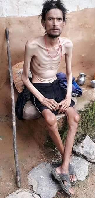 रेखदेख साहित्यः हाड-छालाको जिन्दगी