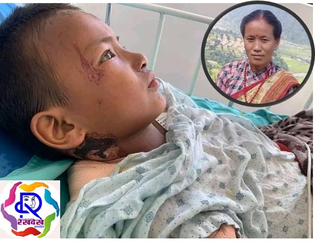 करेन्ट लागेर घाईते छोराको उपचारमा सहयोग गर्न आमाको अपिल